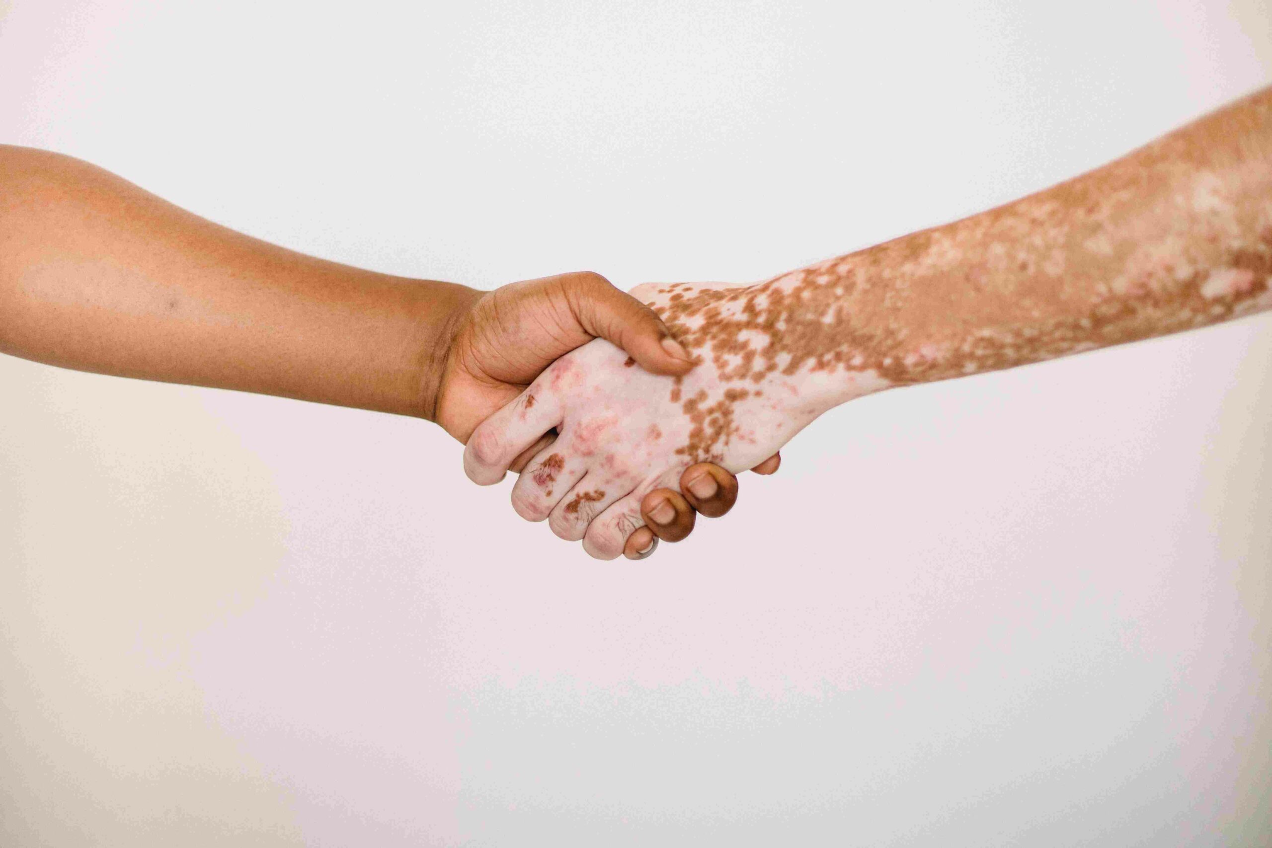 Photo by Armin Rimoldi: https://www.pexels.com/photo/crop-faceless-men-shaking-hands-in-studio-5304052/